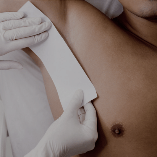 Epilation aisselles